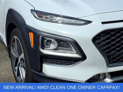 2020 Hyundai Kona Ultimate